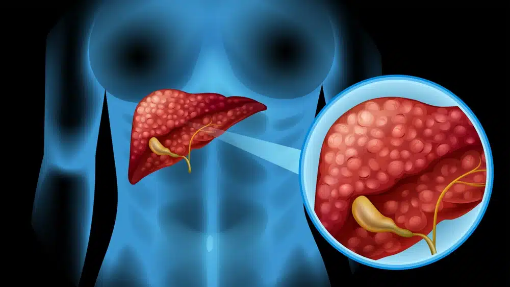 Liver Cleanse Supplement Ingredients