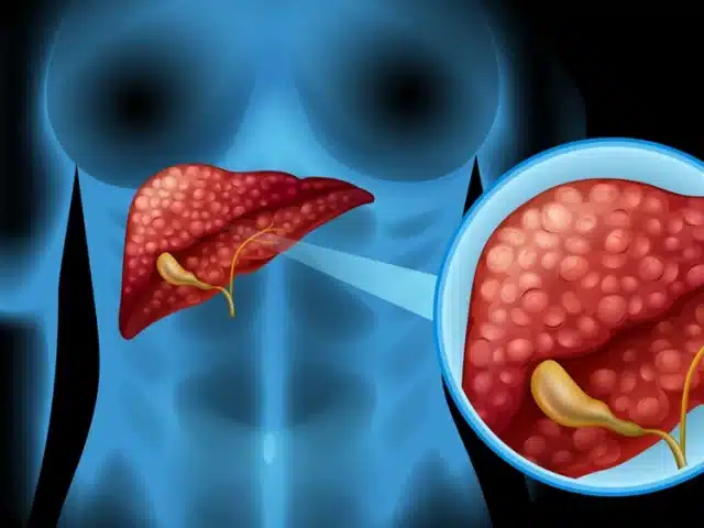 Liver Cleanse Supplement Ingredients: Unlock 2025 Wellness
